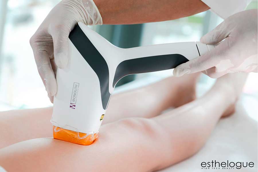 Beauty Clad Epilazione Laser Esthelogue